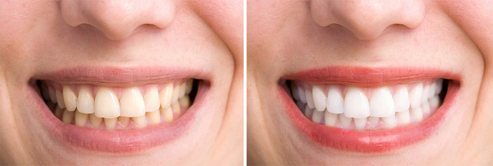 s1-10 How to whiten teeth in Photoshop and make a picture look better