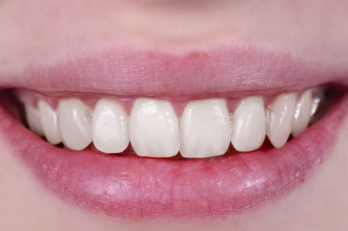 s1-6 How to whiten teeth in Photoshop and make a picture look better