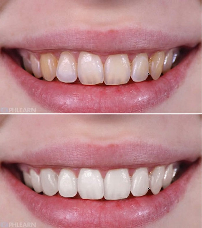 s1-9 How to whiten teeth in Photoshop and make a picture look better