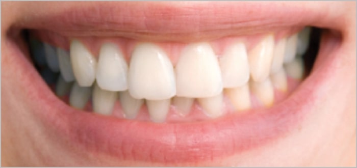 s2-1 How to whiten teeth in Photoshop and make a picture look better