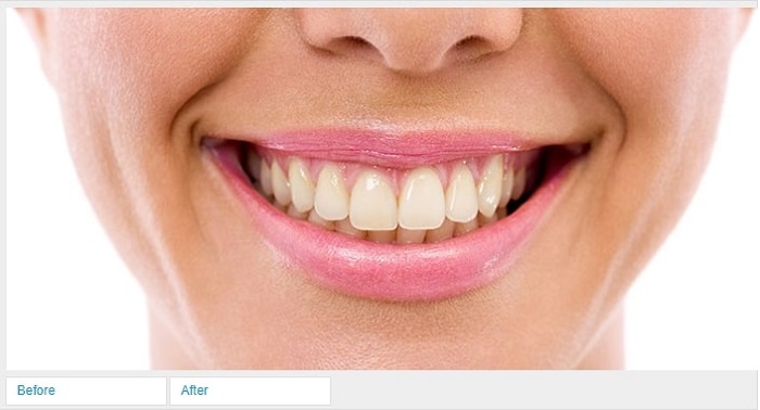 s3-1 How to whiten teeth in Photoshop and make a picture look better